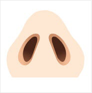 鼻変形による口唇裂の形成